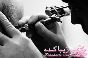 آنچه باید قبل از تاتو یادتان باشد!