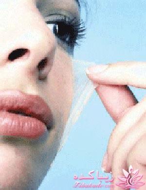 کرم لایه بردار