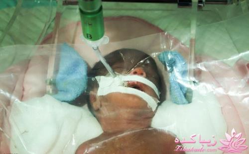 گفت و گویی با پدر شش قلوهای مشهدی