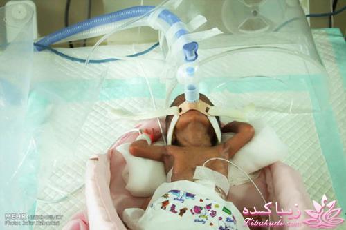 گفت و گویی با پدر شش قلوهای مشهدی