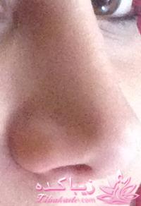 جراحی بینی - جراحی زیبایی