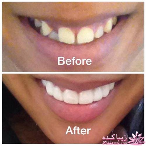 كلينيك زيبايى و ليزر دندانپزشكى دكتر ميرزائى