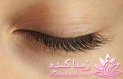 چرا مژه ها می ریزند؟ 