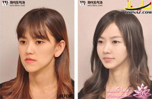 نبوغ کره ای ها در جراحی زیبایی!!!!!!!!!!!!!!!!