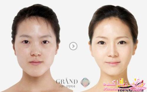 نبوغ کره ای ها در جراحی زیبایی!!!!!!!!!!!!!!!!