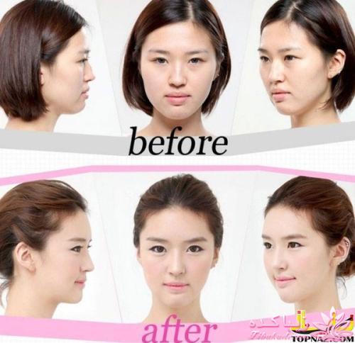 نبوغ کره ای ها در جراحی زیبایی!!!!!!!!!!!!!!!!