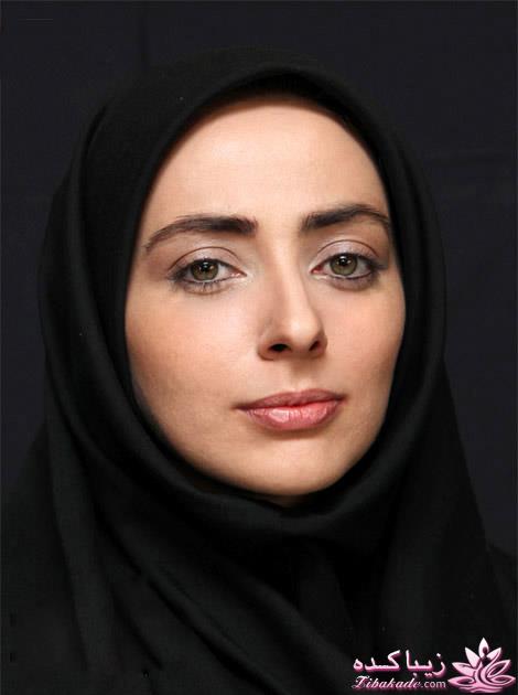 قبل و بعد از عمل بازیگران ایرانی