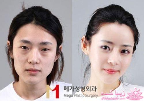 عمل زیبایی بازیگران کره ای