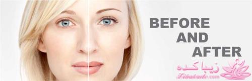 آمیا مرکز تخصصی آرایش دائم - میکروپیگمنتیشن - تاتو ابرو - هاشور ابرو - amiea