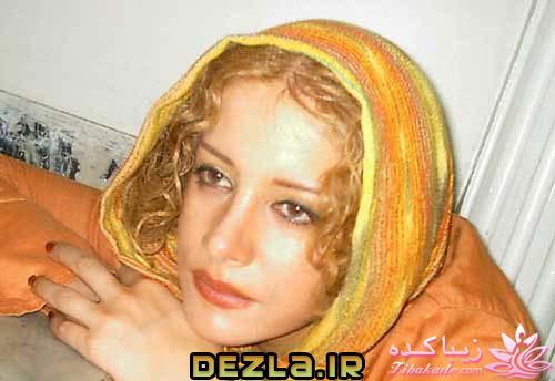 قبل و بعد از عمل بازیگران ایرانی