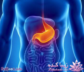 ریفلاکس معده را بهتر بشناسید