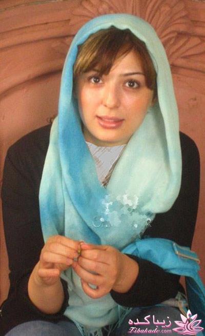 قبل و بعد از عمل بازیگران ایرانی