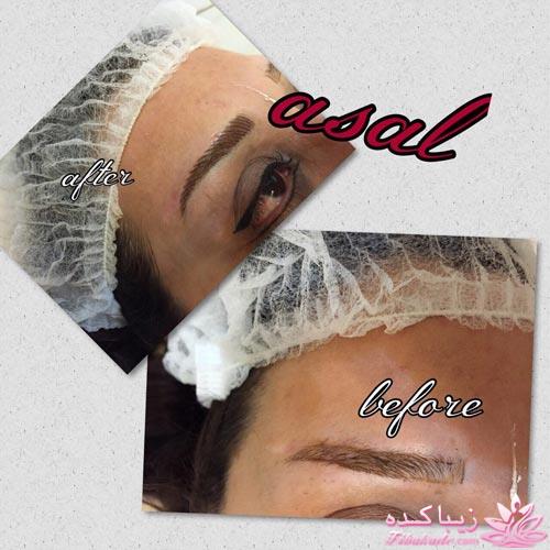 هاشور ابرو - میکروپیگمنتیشن - عسل
