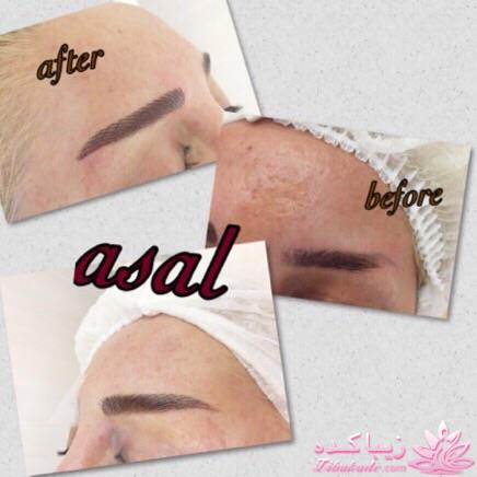 هاشور ابرو - میکروپیگمنتیشن - عسل