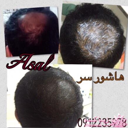 هاشور ابرو - میکروپیگمنتیشن - عسل