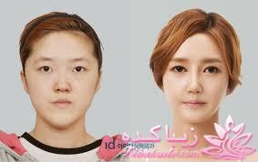نبوغ کره ای ها در جراحی زیبایی!!!!!!!!!!!!!!!!