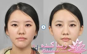 نبوغ کره ای ها در جراحی زیبایی!!!!!!!!!!!!!!!!