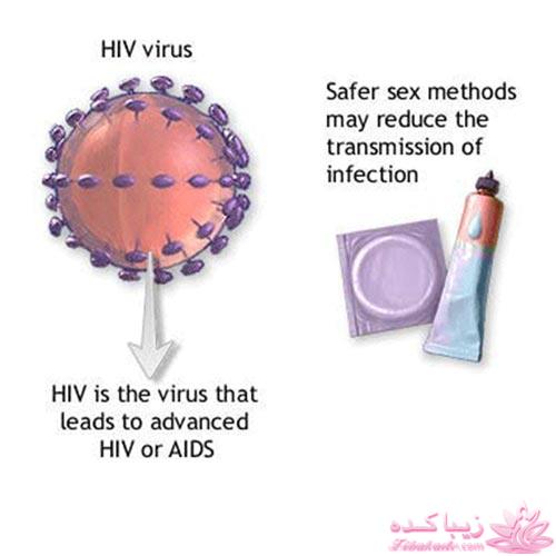 کاندوم - کاندوم زنانه در ایران برای نخستین بار