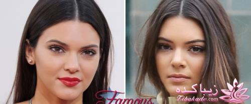 جراحی بینی - جراحی زیبایی