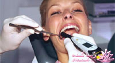 دیاگنودنت برترین دستگاه تشخیص پوسیدگی در جهان