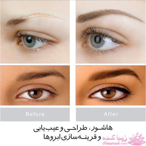 هاشور ابرو - میکروپیگمنتیشن - آفاق