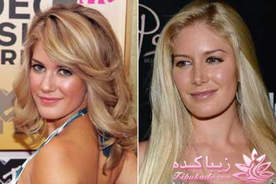 جراحی بینی - جراحی زیبایی