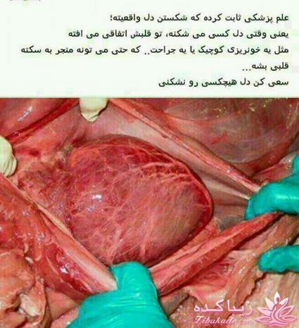 علم پزشکی ثابت کرده شکستن دل واقعیه