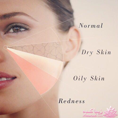 انواع پوست و نحوه مراقبت