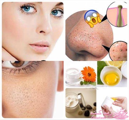 از بین بردن منافذ باز پوست و جوشهای سرسیاه