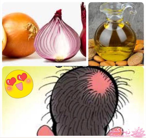 مشکلات مو و درمان آن