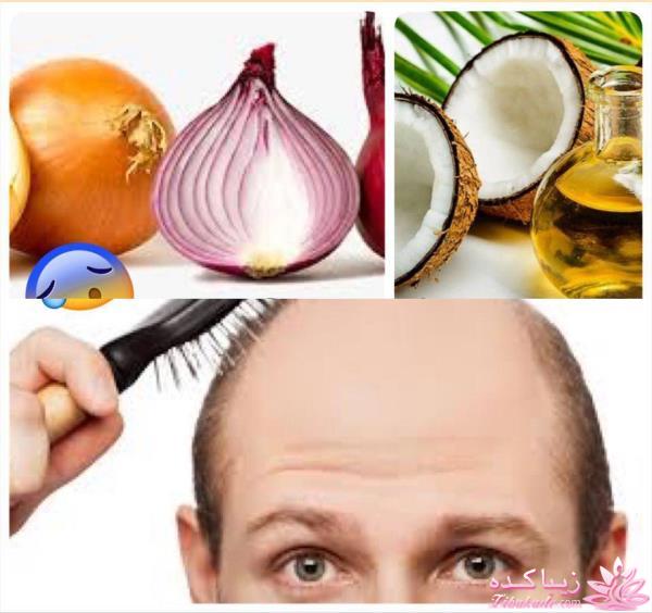 مشکلات مو و درمان آن