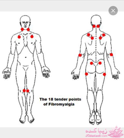 ضایعات عضلانی و عصبی