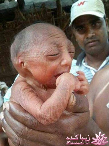 تولد نوزاد 110 ساله !