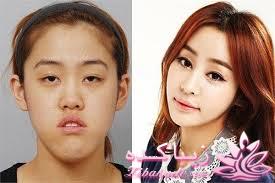 نبوغ کره ای ها در جراحی زیبایی!!!!!!!!!!!!!!!!