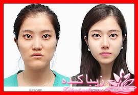 نبوغ کره ای ها در جراحی زیبایی!!!!!!!!!!!!!!!!