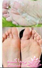 درمان ترک پا در 15 دقیقه با لیمو