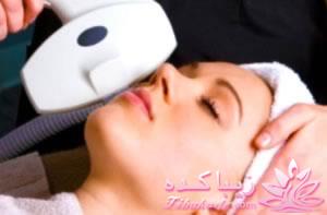 لیزر موهای زائد برای چه کسانی ممنوع است؟