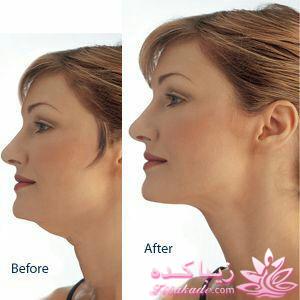 چگونه زیبا شوم