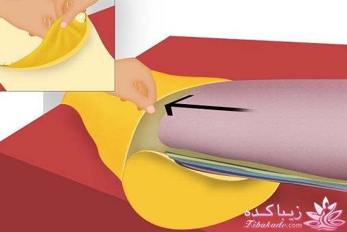 آموزش دوخت سیسمونی نوزاد