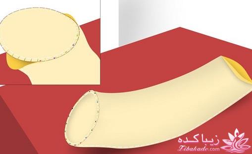 آموزش دوخت سیسمونی نوزاد