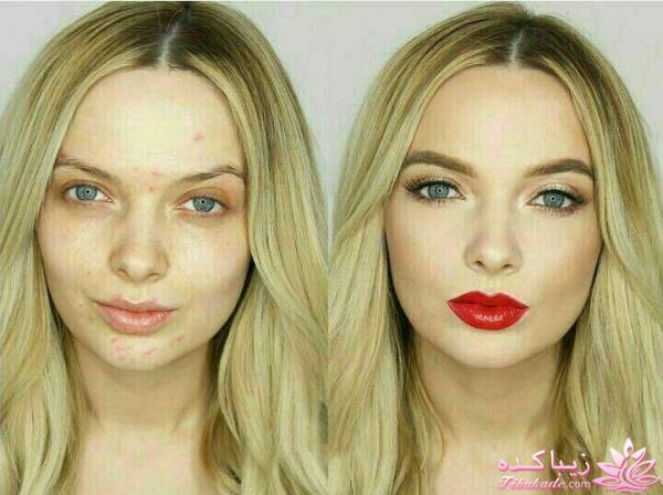 برطرف کردن جای جوش