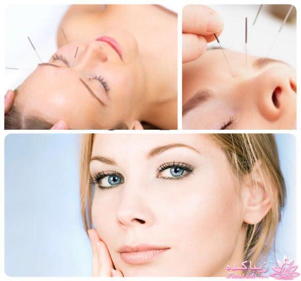 راههای چاق شدن صورت