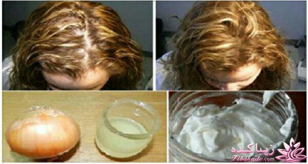 مشکلات مو و درمان آن