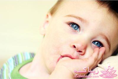 عوارض دندانپزشکی مکیدن انگشت