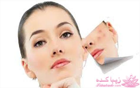 مراقبت از پوست