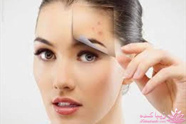 مراقبت از پوست