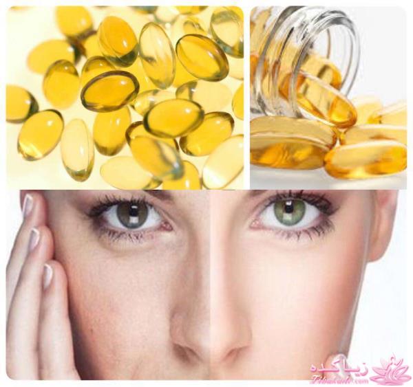 درمان لکه های قهوه ای پوست