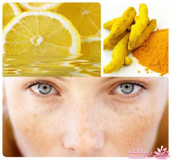 درمان لکه های قهوه ای پوست