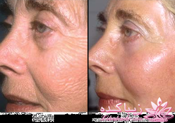 مرکز زیبایی ابریشم نقره ای