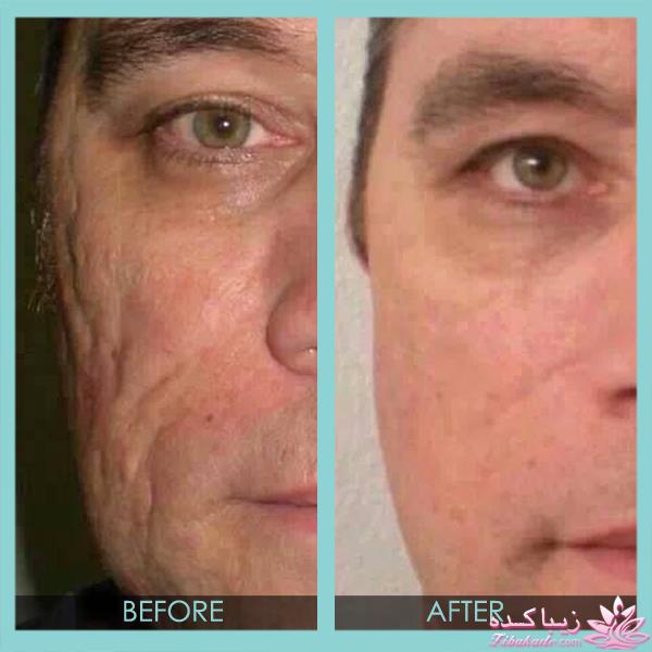 مرکز زیبایی ابریشم نقره ای